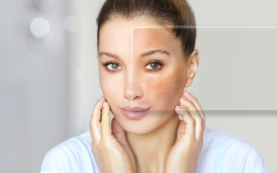 Find Skin lightening clinic in Hadapsar