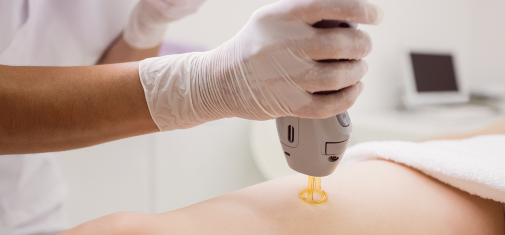 Understanding Hair Growth Cycles: Why Timing Matters For LHR Results