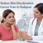 How to Reduce Skin Discoloration and Uneven Tone in Hadapsar