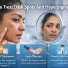 How To Treat Dark Spots And Hyperpigmentation